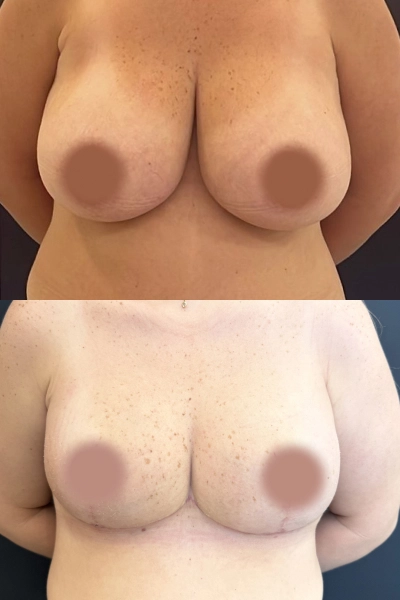 05